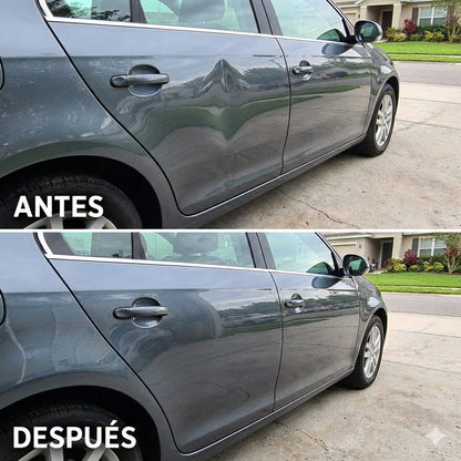 DentSave Pro™- Evita pagar talleres caros y Protege tu dinero